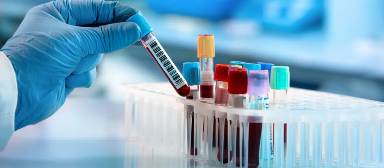 Sizing a Niche Healthcare Market in 3 Weeks: A Pre-Feasibility Case Study
