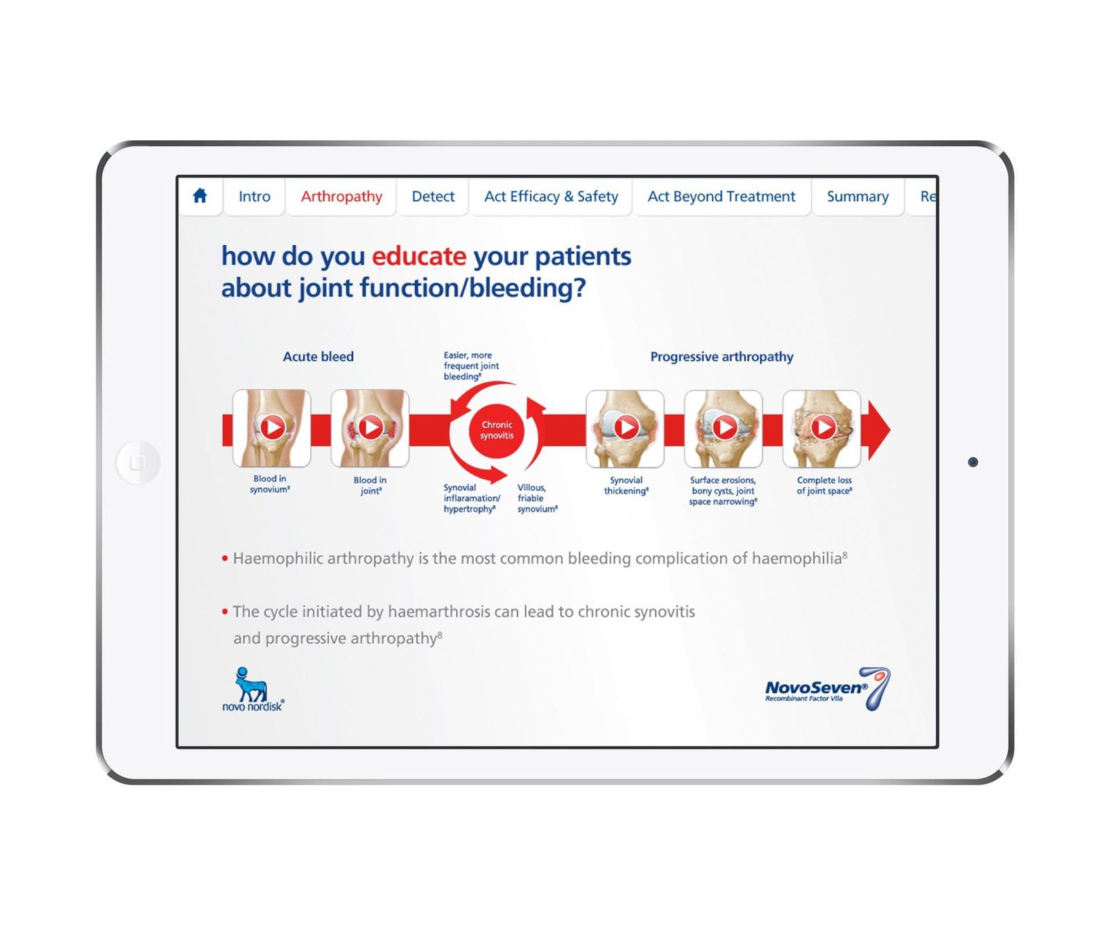 Interaktiv eDetailer-slide på iPad viser progression af blødningsartropa med videoer og medicinsk information