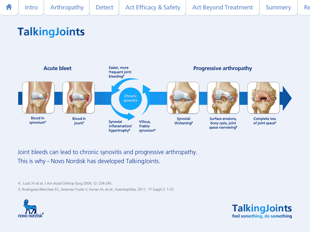 Infografik over joint bleed progression til haemophilia-undervisning med 3D anatomiske illustrationer