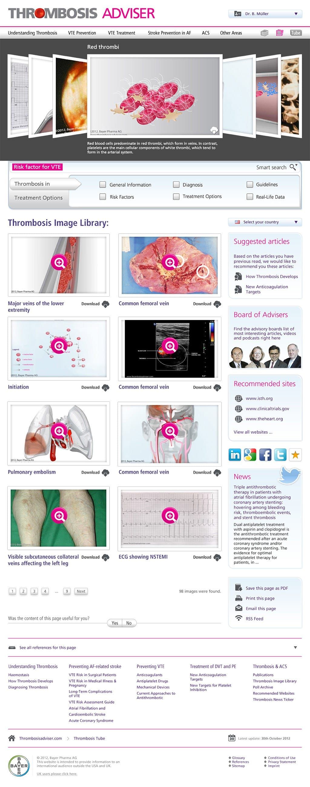 Produktdesign af medicinsk informationsportal med interaktive illustrationer af blodpropper og vaskulære anatomi