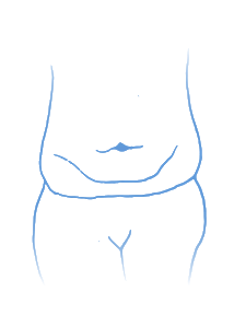 Stubborn belly fat illustration 