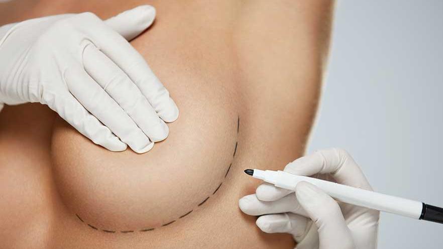 Breast Augmentation Surgery service thumbnail