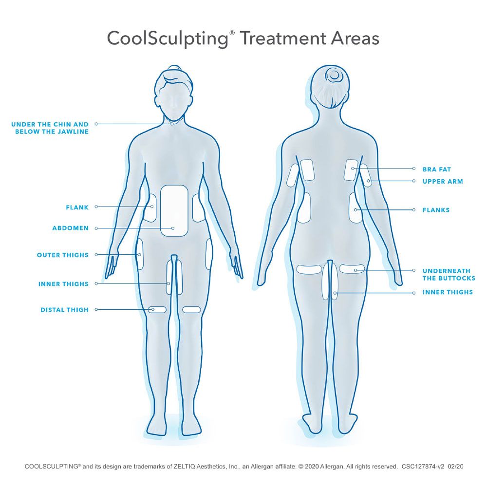 treatment areas for coolsculpting body diagram