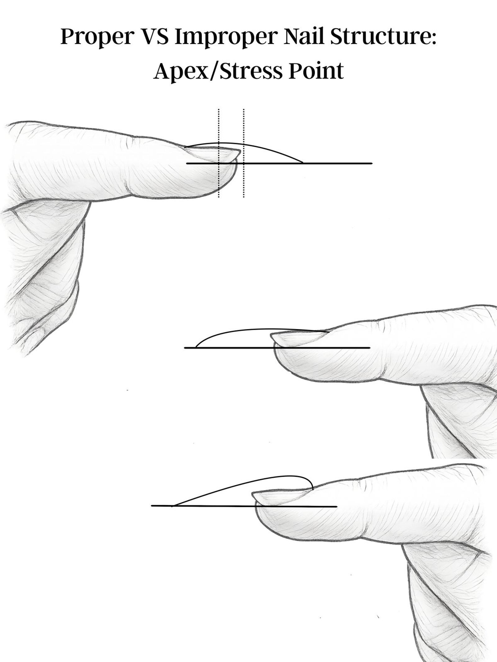 Proper vs improper apex and stress point placement on a nail enhancement