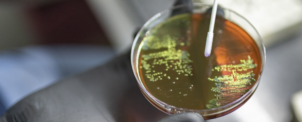 CEDAR — CYMG Conference on the Environmental Dimensions of Antimicrobial Resistance