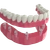 Implant with base