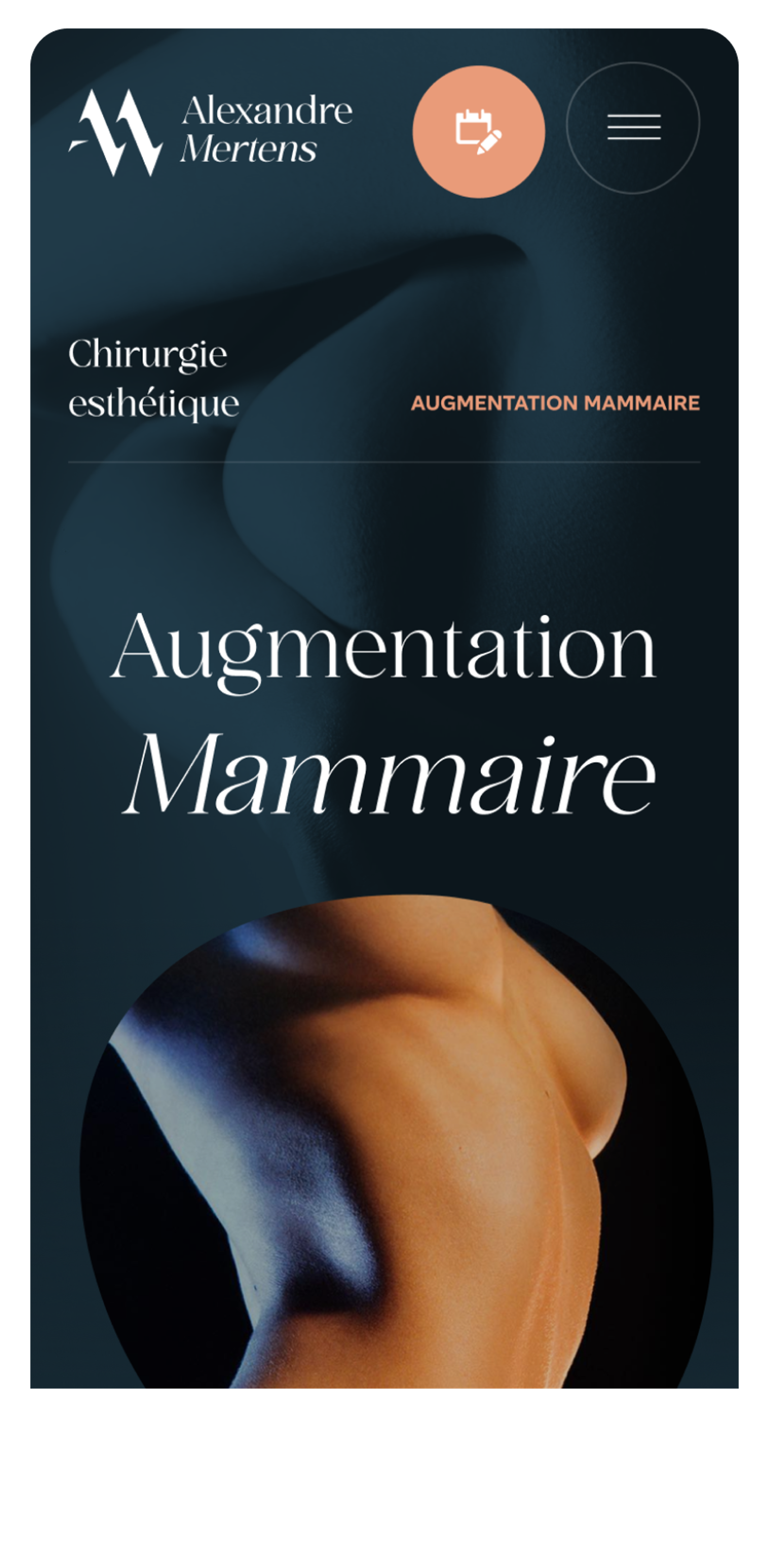 Alexandre Mertens breast augmentation mobile section