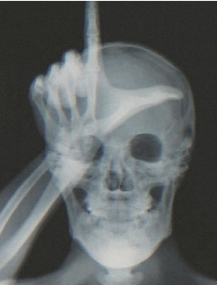 Photo de jérémy akaru agence lyon