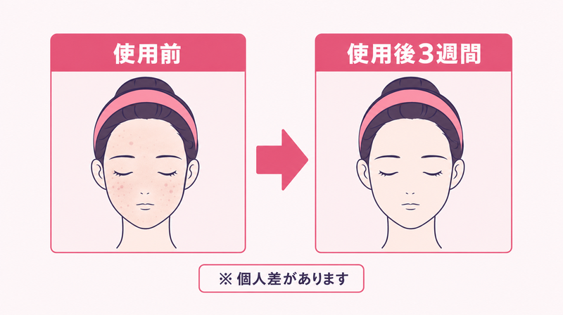 化粧品バナー広告のビフォーアフター型の構成要素と薬機法注記の図解