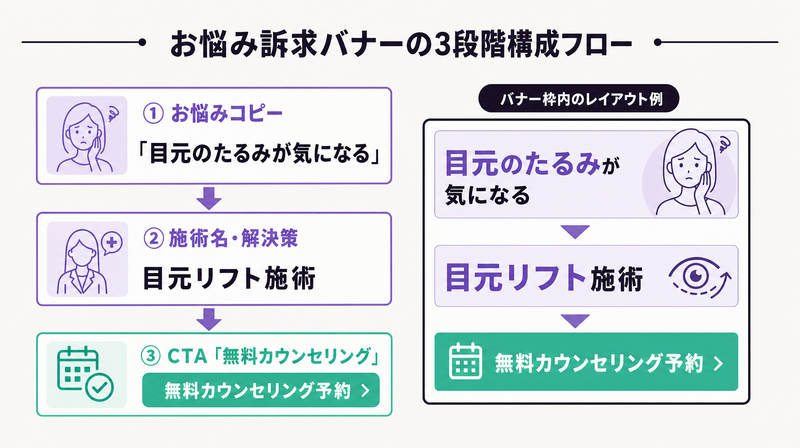 美容クリニックのお悩み訴求バナー構成3ステップ（悩み→施術→CTA）