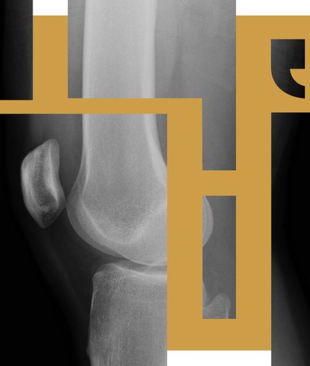 Brudd er tema for årets Kapittel. Profil: Solv ved Maren Dreggevik